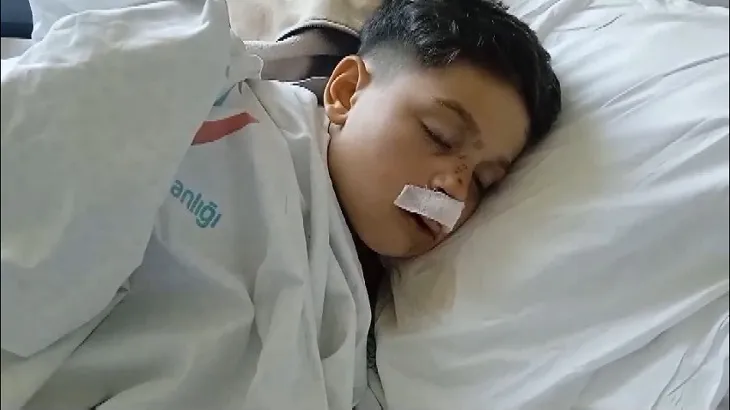 İki kişinin kendi halinde tahterevallide oynarken düşürdükleri çocuk ağır yaralandı