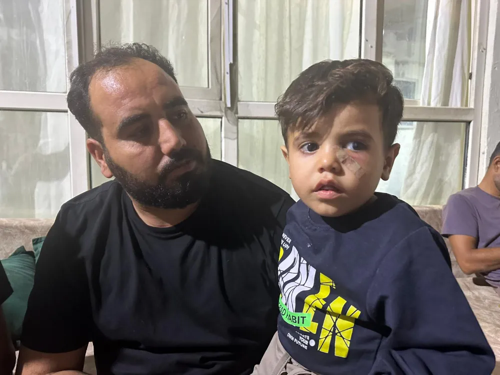 Yorgun mermi, 4 yaşındaki çocuğun gözünün altına isabet etti