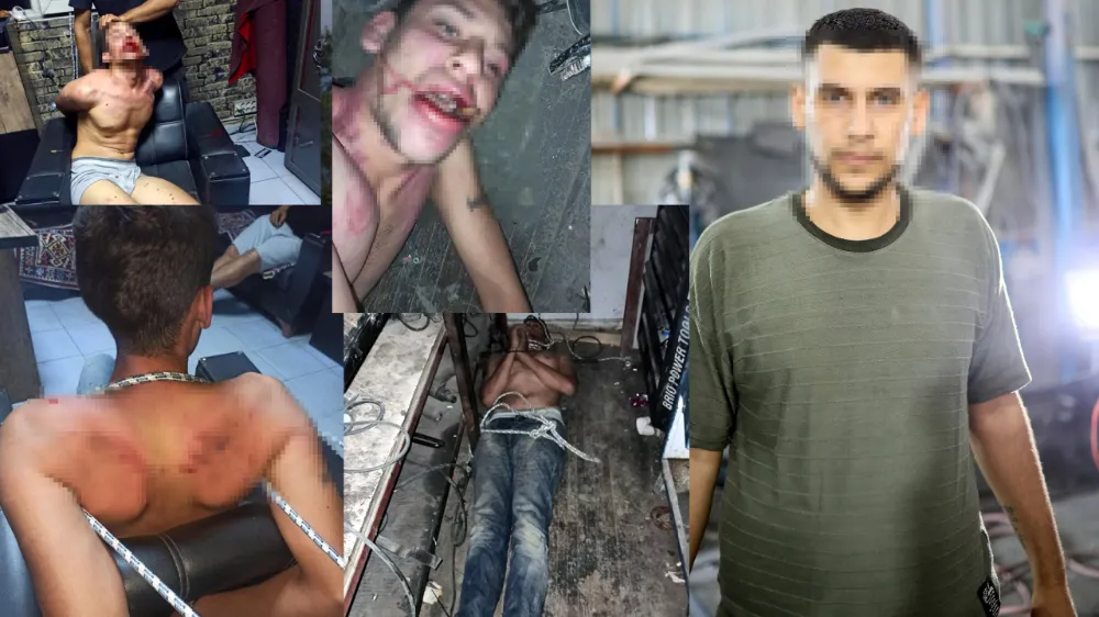 3 gün işkence gören adam,Adli Tıp raporuna isyan etti