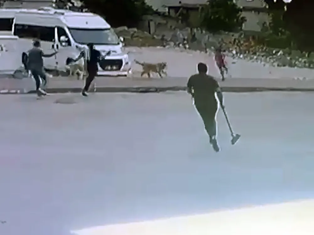 Sokak köpeklerinin saldırdığı çocuğu esnaf kurtardı