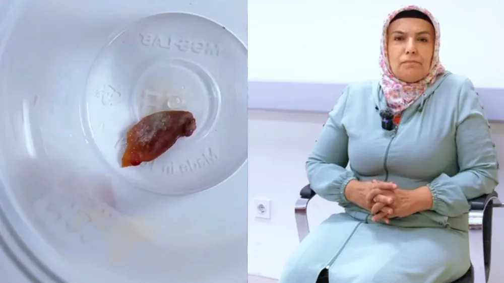 Malatya